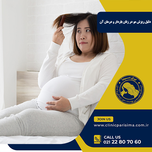 دلیل ریزش مو در زنان باردار و درمان آن
