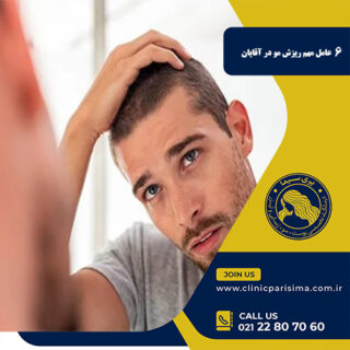 ریزش مو در آقایان