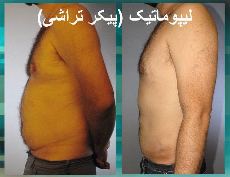 پیکر تراشی