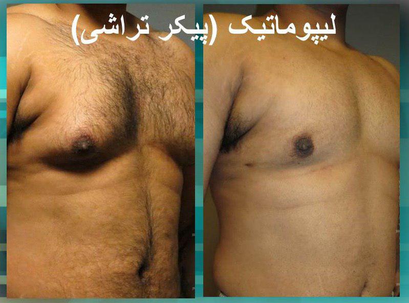 پیکر تراشی1