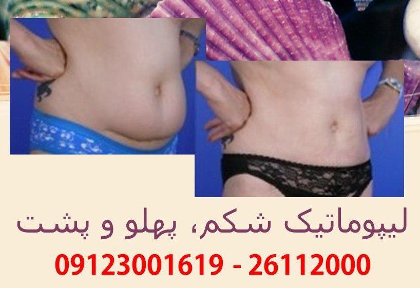 پیکر تراشی10