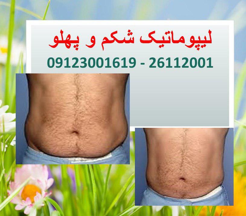 پیکر تراشی11