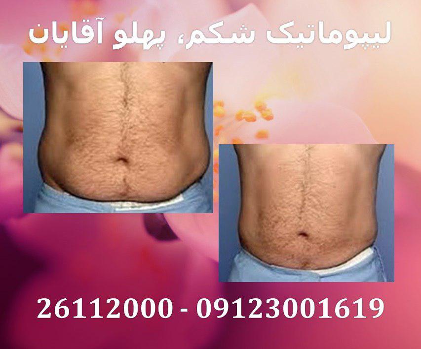 پیکر تراشی13