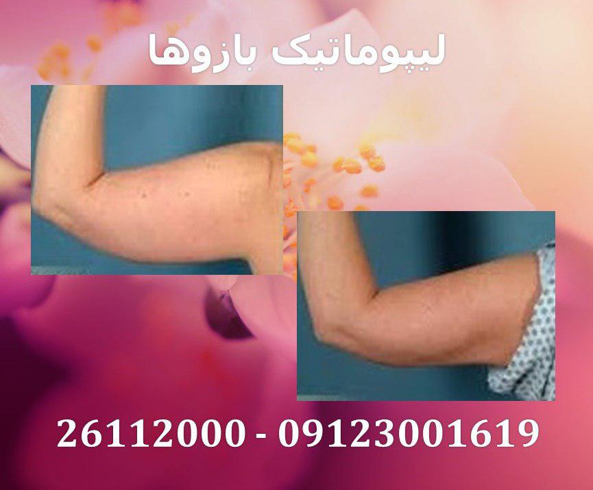 پیکر تراشی14