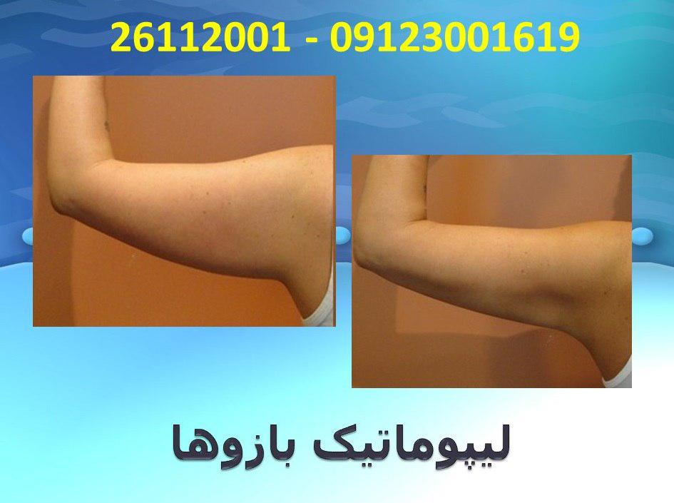 پیکر تراشی15