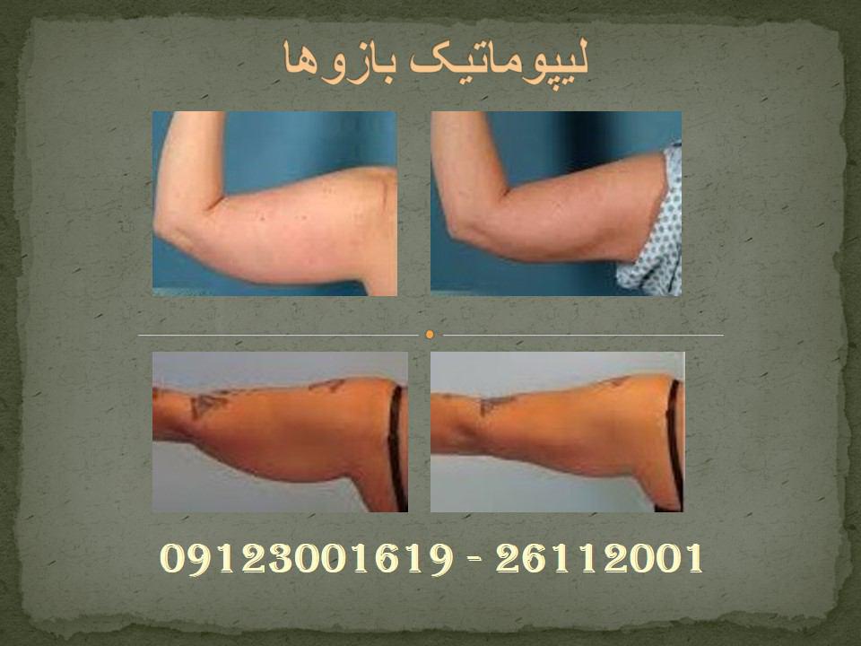 پیکر تراشی18