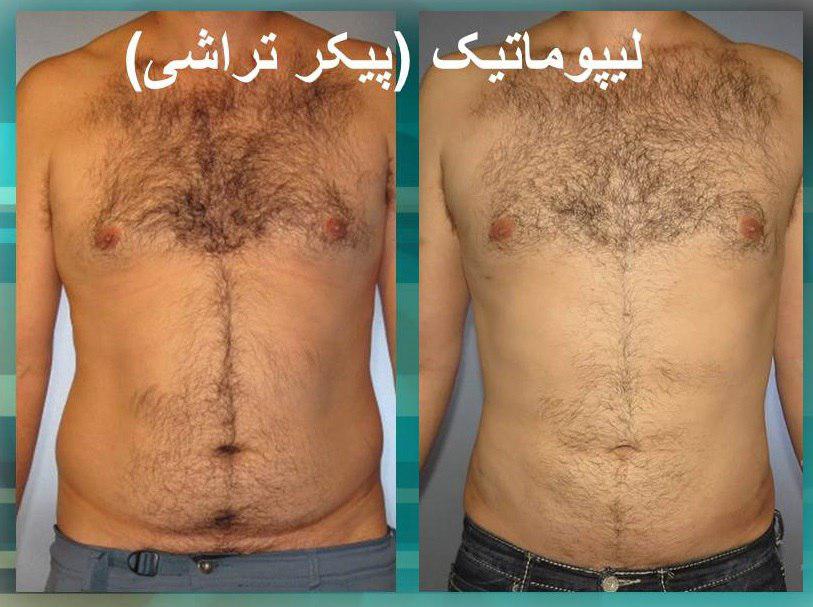 پیکر تراشی3