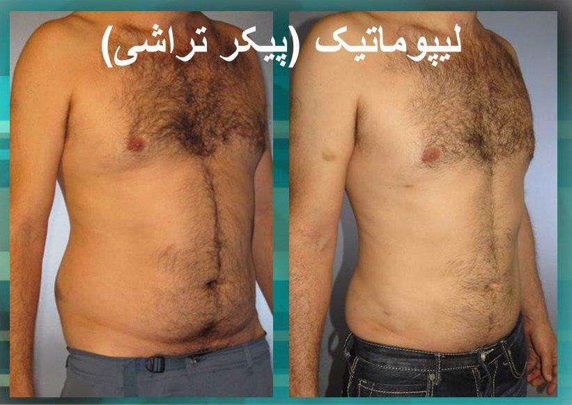 پیکر تراشی4
