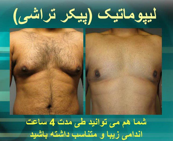 پیکر تراشی5