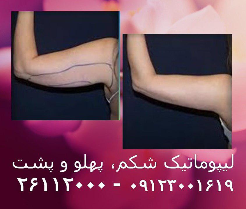 پیکر تراشی8
