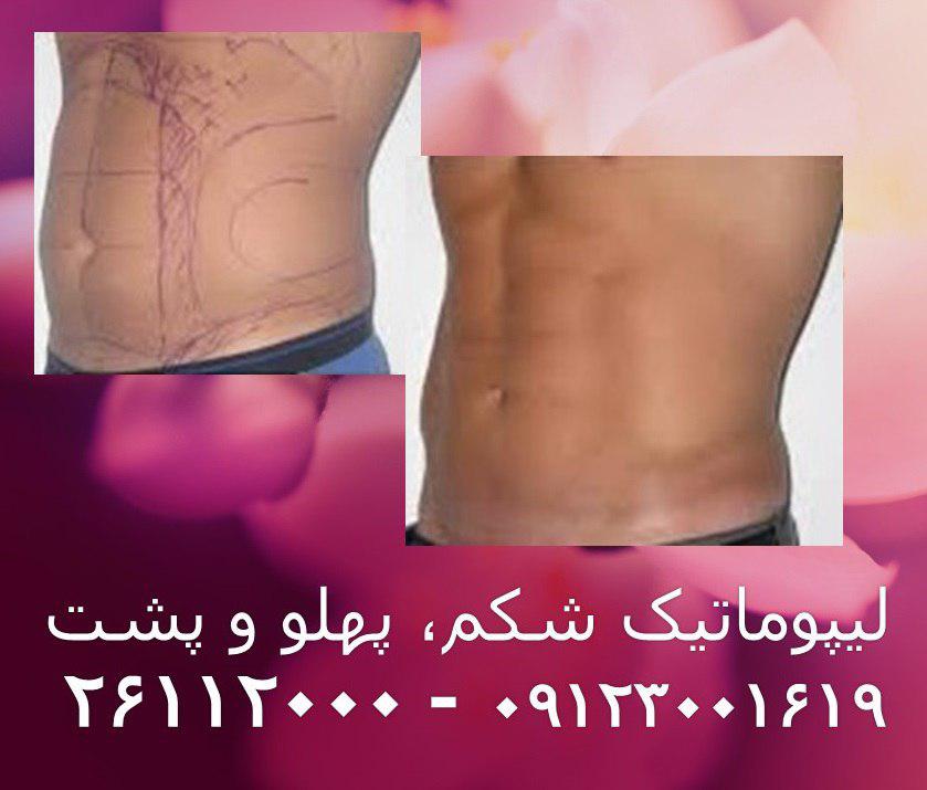 پیکر تراشی9