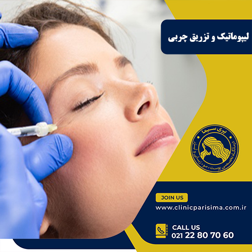 لیپوماتیک و تزریق چربی