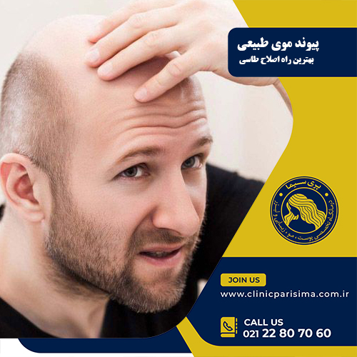 اصلاح طاسی