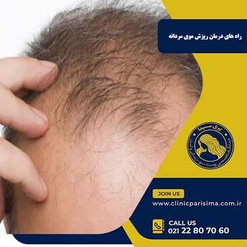 راه های درمان ریزش موی مردانه