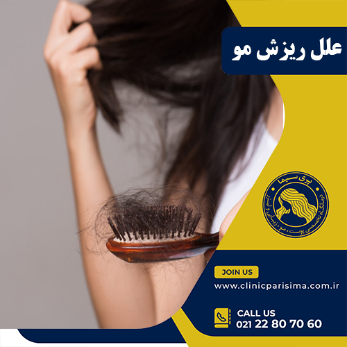 علل ریزش مو