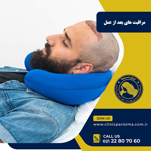 مراقبت های بعد از عمل