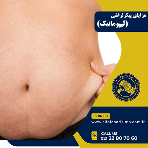 مزایای پیکرتراشی