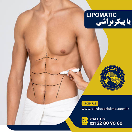 پیکر تراشی