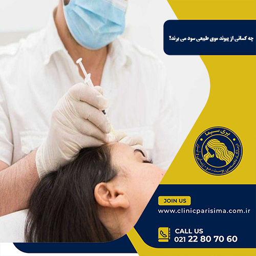 چه کسانی از پیوند موی طبیعی سود می برند؟