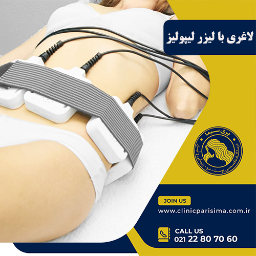لیزر لیپولیز - کلینیک پری سیما