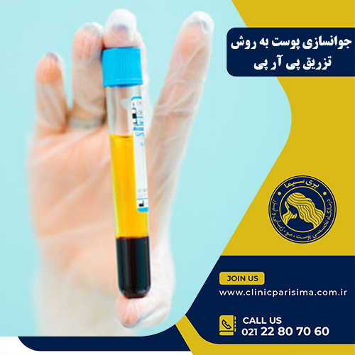 تزریق پی آر پی - کلینیک پریسیما